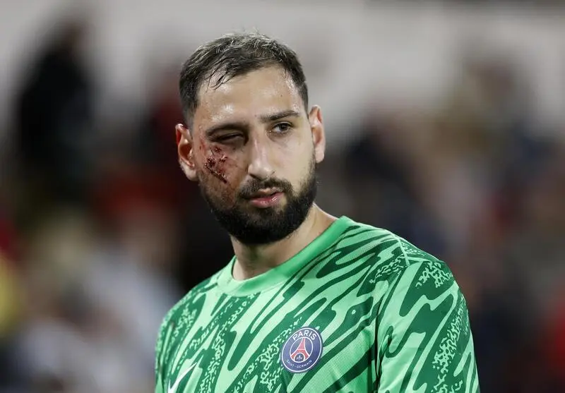 Este es el estado de Donnarumma tras el golpazo en el Mónaco vs PSG